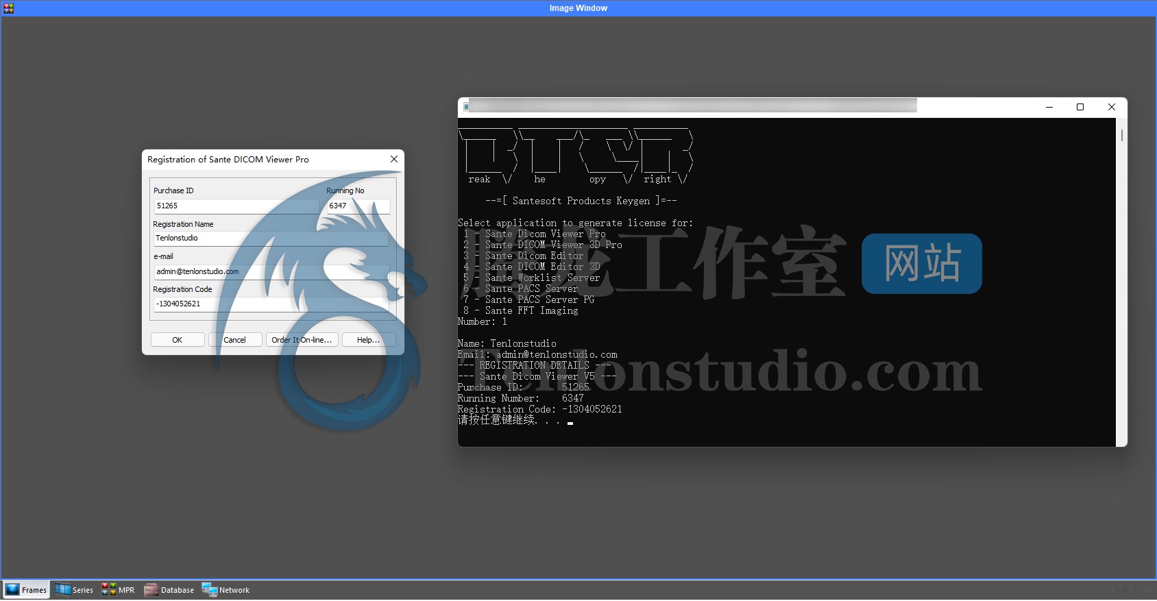 DICOM医学影像浏览器 Sante DICOM Viewer Pro v14.0.2 破解版插图1 DICOM医学影像浏览器 Sante DICOM Viewer Pro v14.0.2 破解版插图1