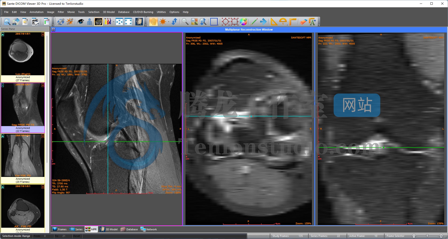 DICOM医学影像浏览器 Sante DICOM Viewer 3D Pro v4.9.4 破解版插图