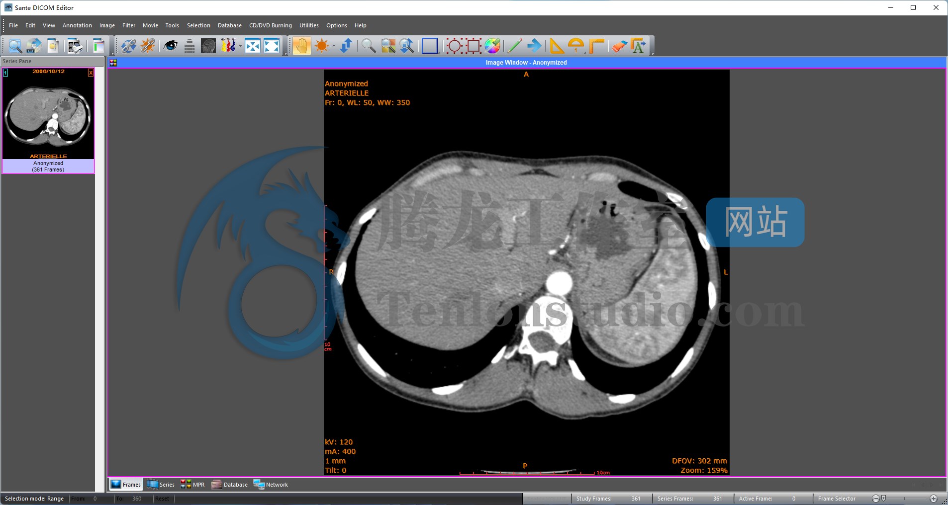 Sante DICOM Editor 8.2.5 instal the new for windows Sante DICOM Editor 8.2.5 instal the new for windows