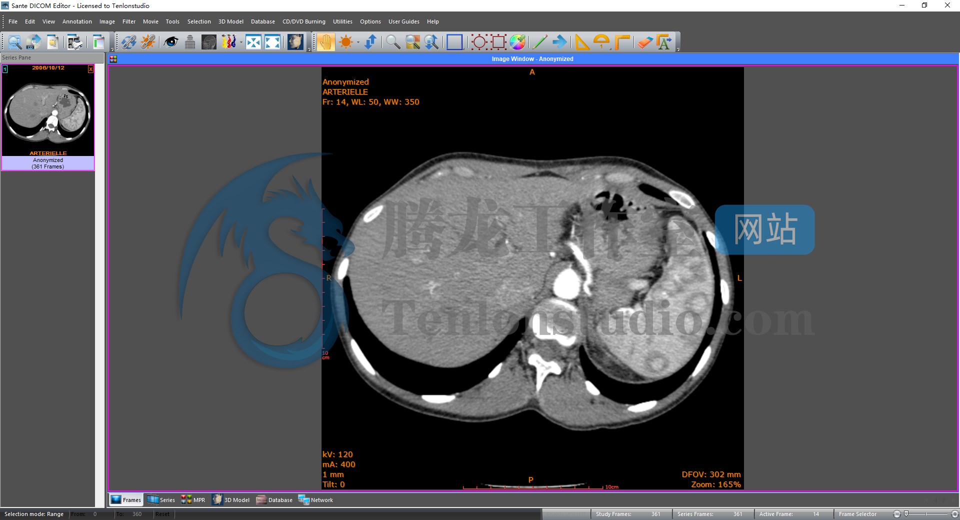 DICOM医学影像编辑器 Sante DICOM Editor v8.2.7 破解版插图 DICOM医学影像编辑器 Sante DICOM Editor v8.2.7 破解版插图