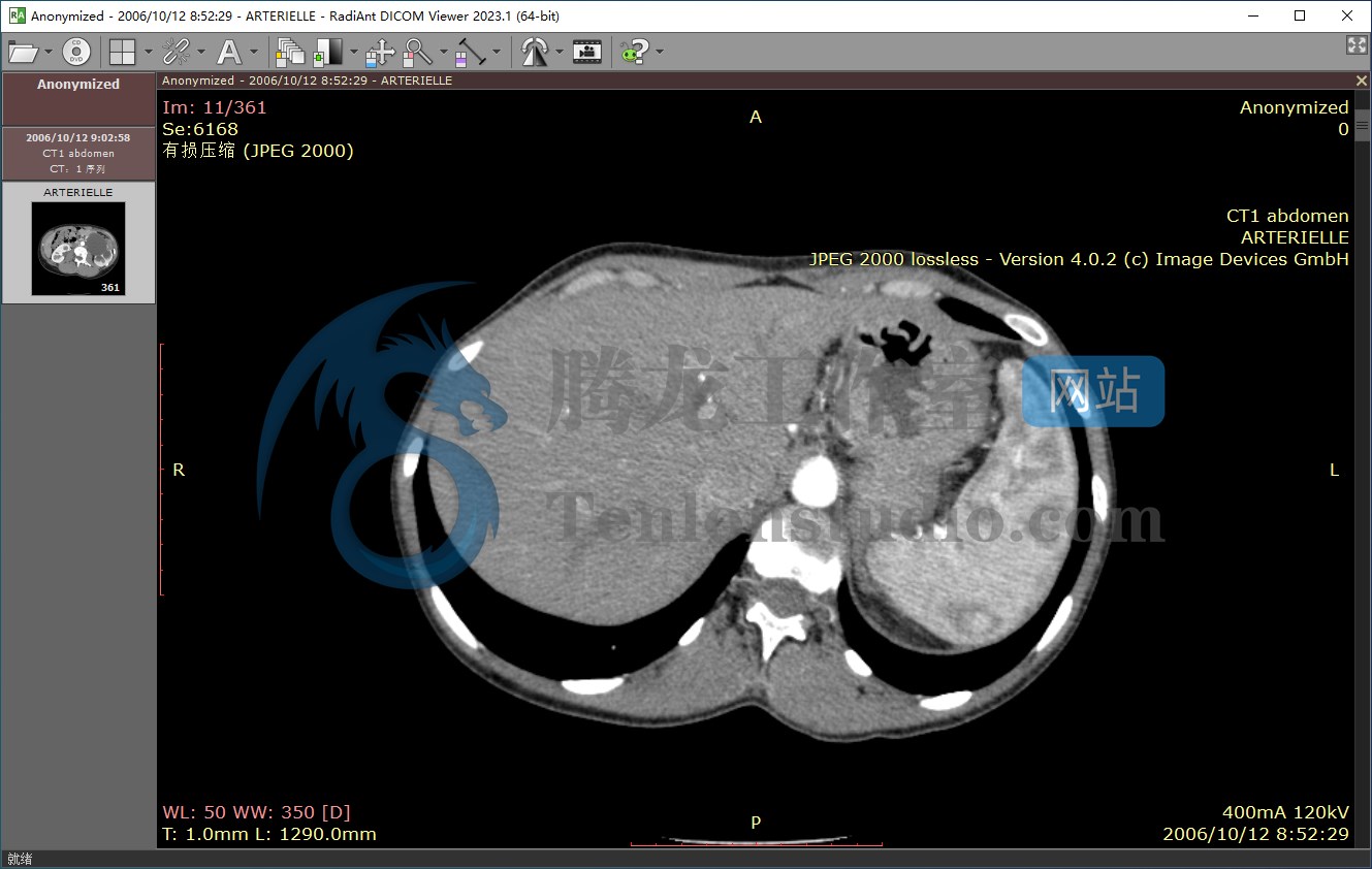 DICOM医学影像浏览器 RadiAnt DICOM Viewer v2023.1 破解版插图 DICOM医学影像浏览器 RadiAnt DICOM Viewer v2023.1 破解版插图
