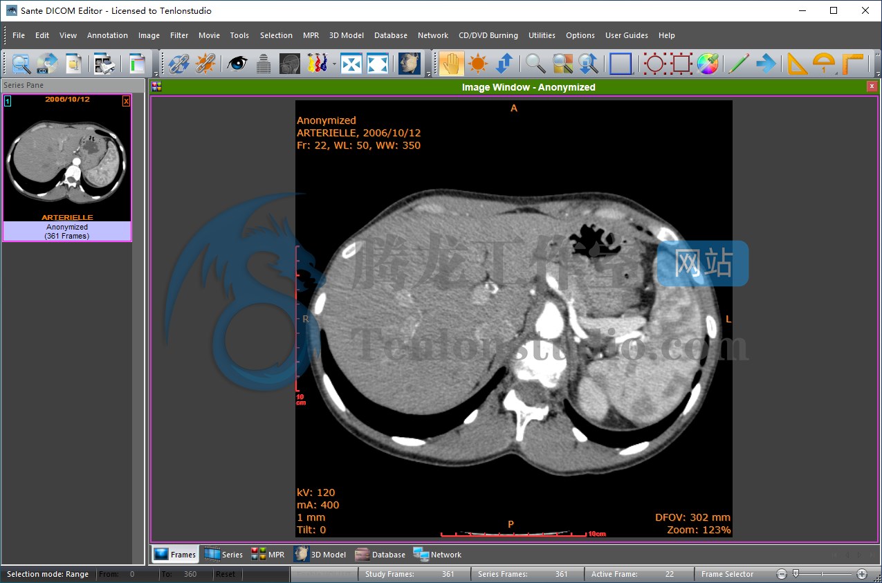 DICOM医学影像编辑器 Sante DICOM Editor v10.0.2 破解版插图 DICOM医学影像编辑器 Sante DICOM Editor v10.0.2 破解版插图