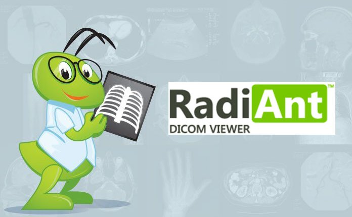 DICOM医学影像浏览器 RadiAnt DICOM Viewer v2024.1 便携版