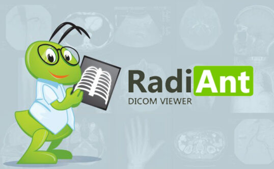 DICOM医学影像浏览器 RadiAnt DICOM Viewer v2025.1 便携版