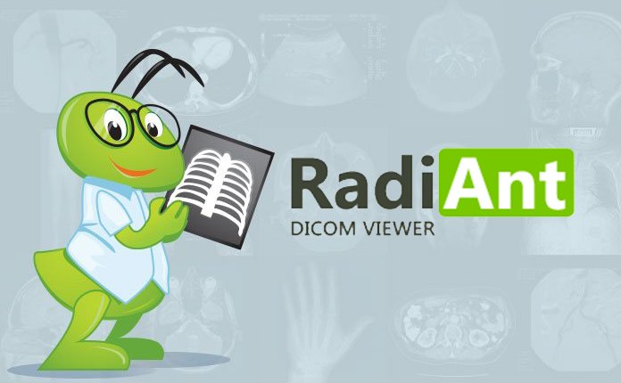 DICOM医学影像浏览器 RadiAnt DICOM Viewer v2025.1 便携版